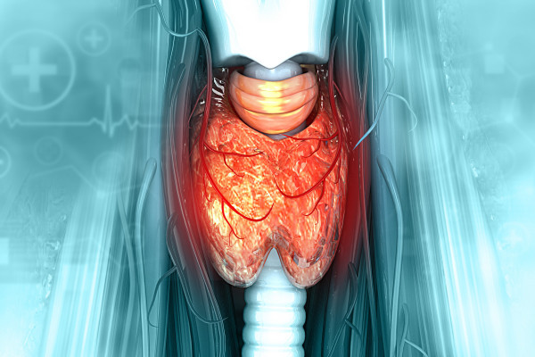 Kabozantinib v léčbě diferencovaných karcinomů štítné žlázy