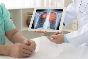 Ověřte si své znalosti o metastatickém NSCLC