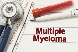 Novinky v diagnostice a léčbě mnohočetného myelomu