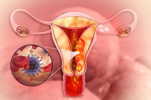 Systémová léčba recidivujícího karcinomu endometria a děložního hrdla – nové možnosti