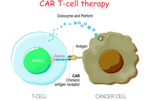 CAR-T buněčná terapie jako horká novinka v revmatologii - podcast