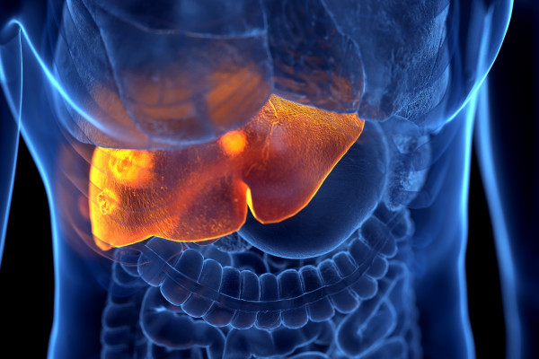 Hepatocelulární karcinom – imunoterapie jako preferovaná volba