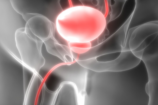 Uroteliální karcinom – kombinace, která mění hru