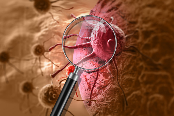 Precizní onkologie a moderní léčba rakoviny pomáhá a není jen pro vyvolené, potvrzuje česká studie